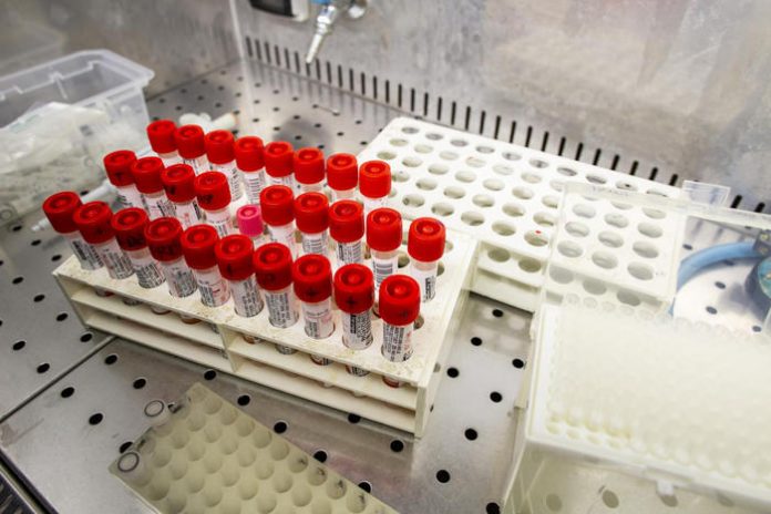 CORONAVIRUS: SI VEDONO EFFETTI MISURE, VICINI A PICCO